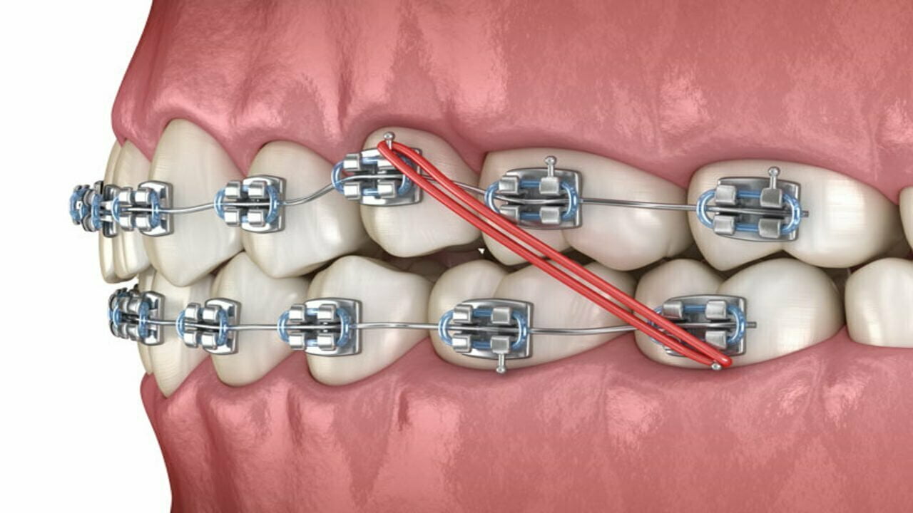 15-best-orthodontist-colleges-in-2024-best-dental-school-orthodontists